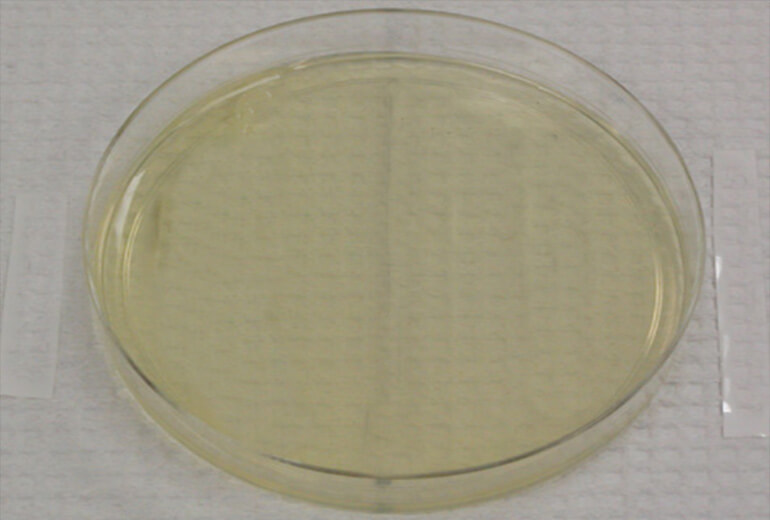 Phenylethyl Alcohol